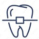 Orthodontic Treatment in Ranchi