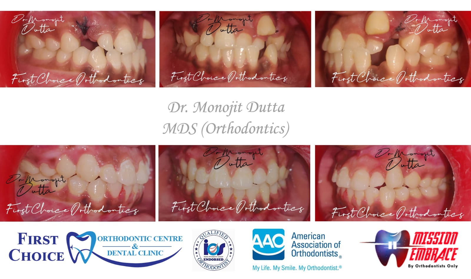First Choice Dental Clinic in Ranchi