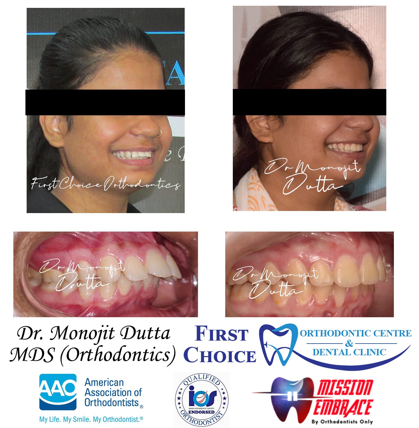Dental Treatment Room in Ranchi