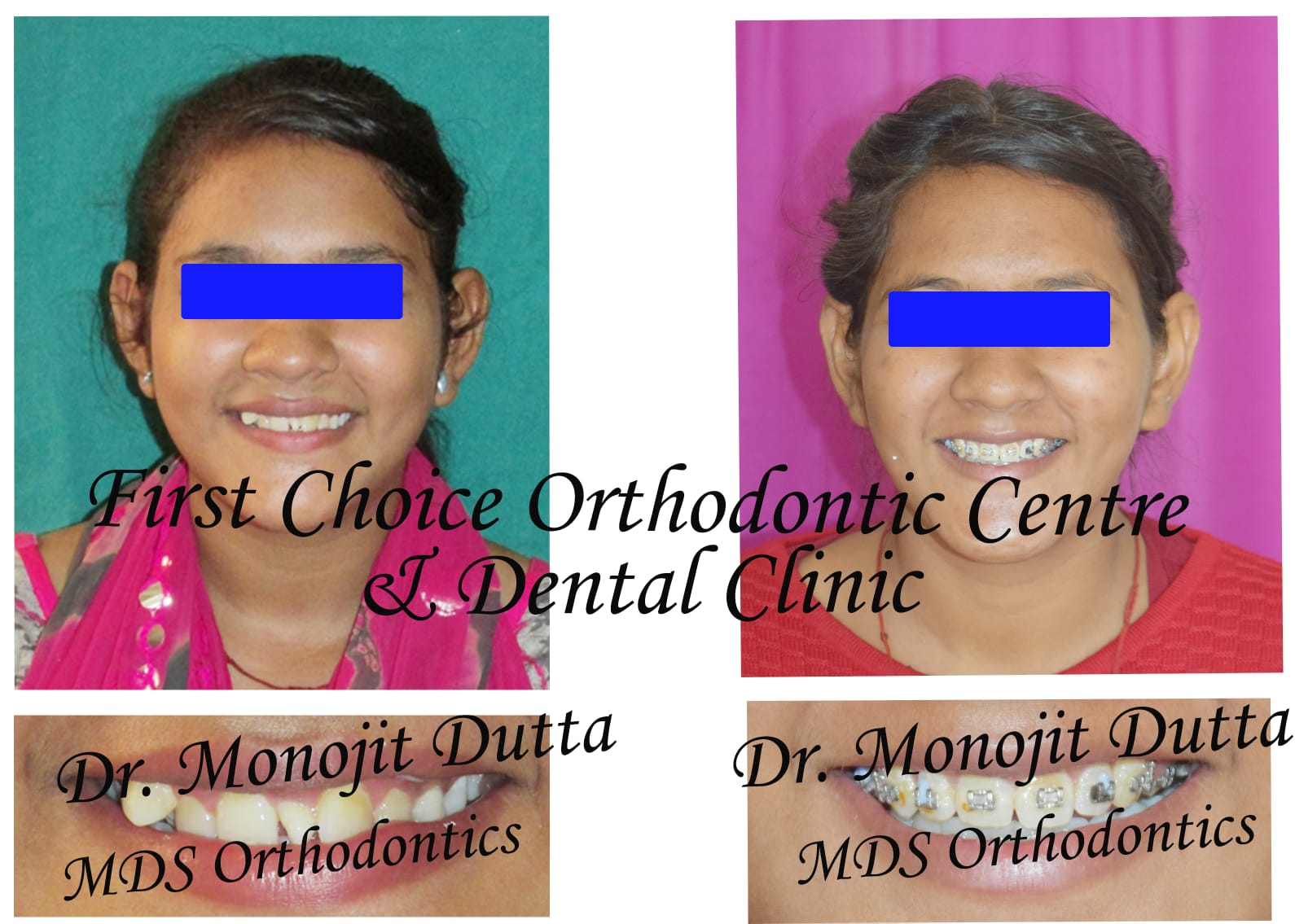 Dental Equipment at First Choice Ranchi