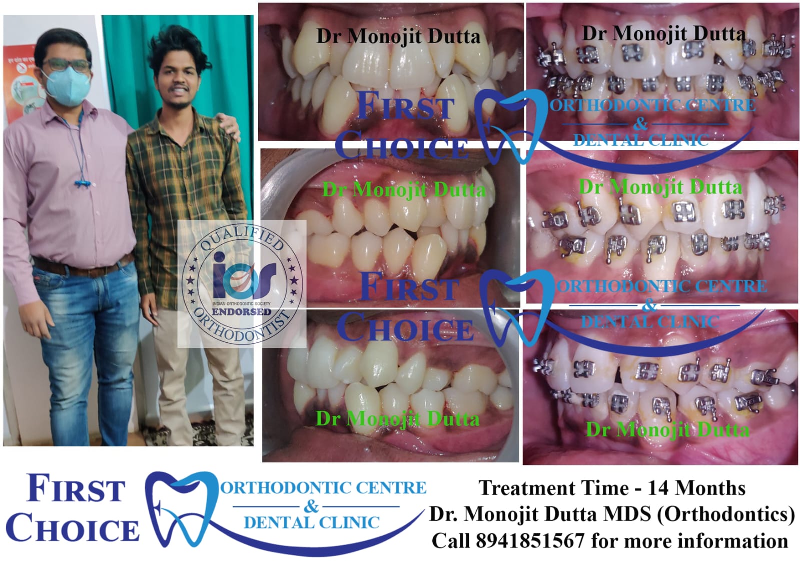 Dental Equipment at First Choice Ranchi