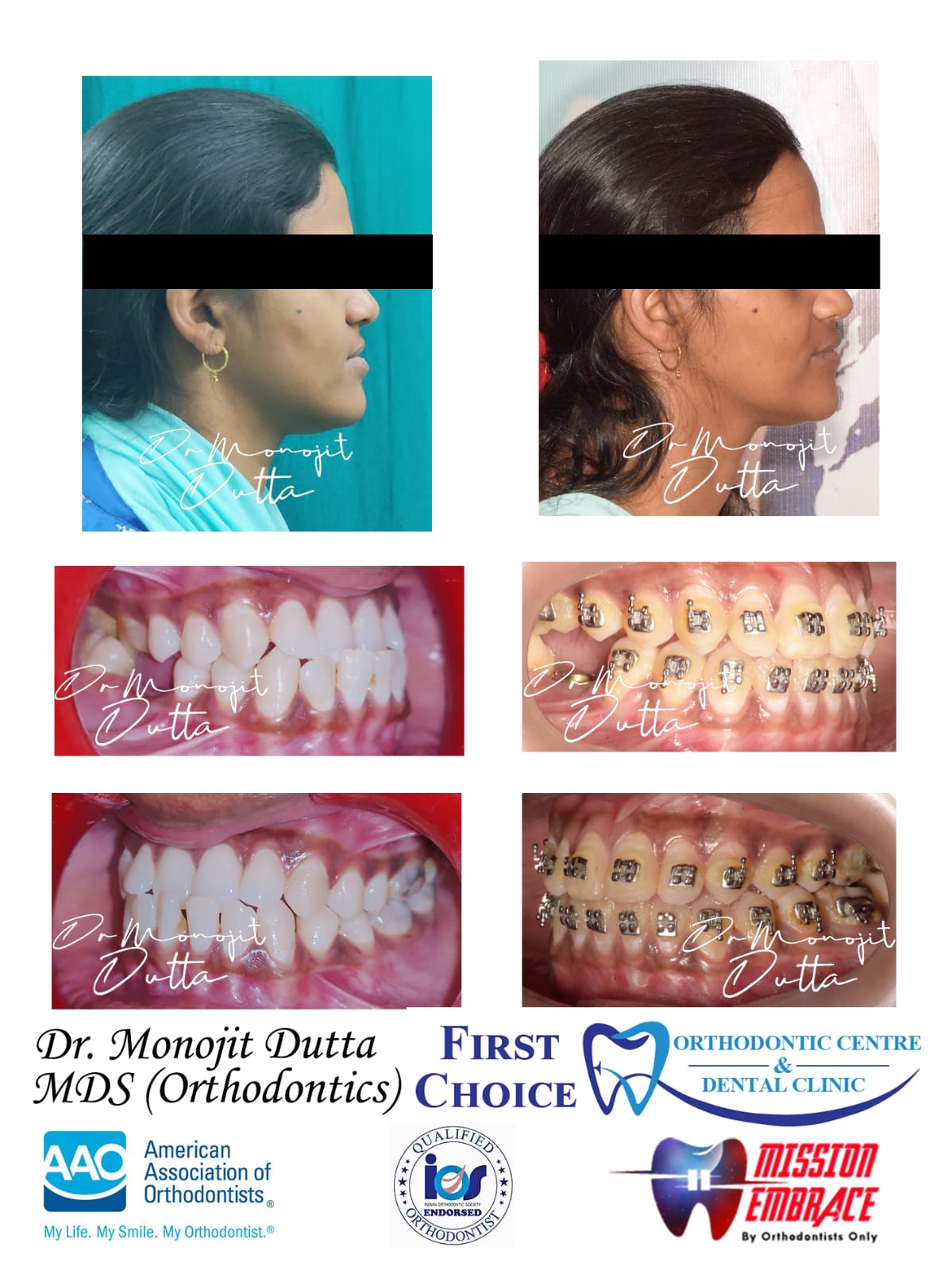 Dental Equipment at First Choice Ranchi