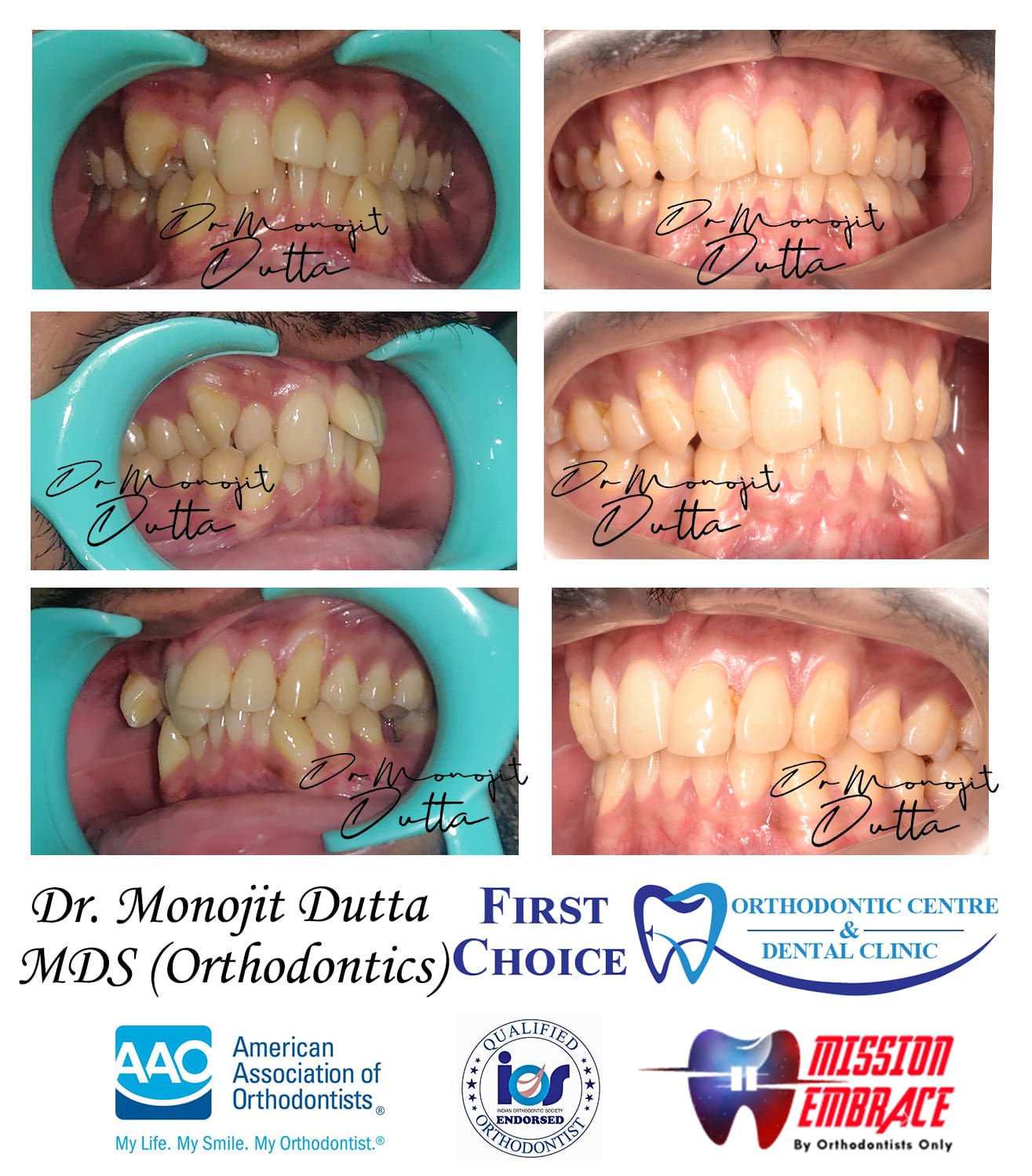 Dental Equipment at First Choice Ranchi