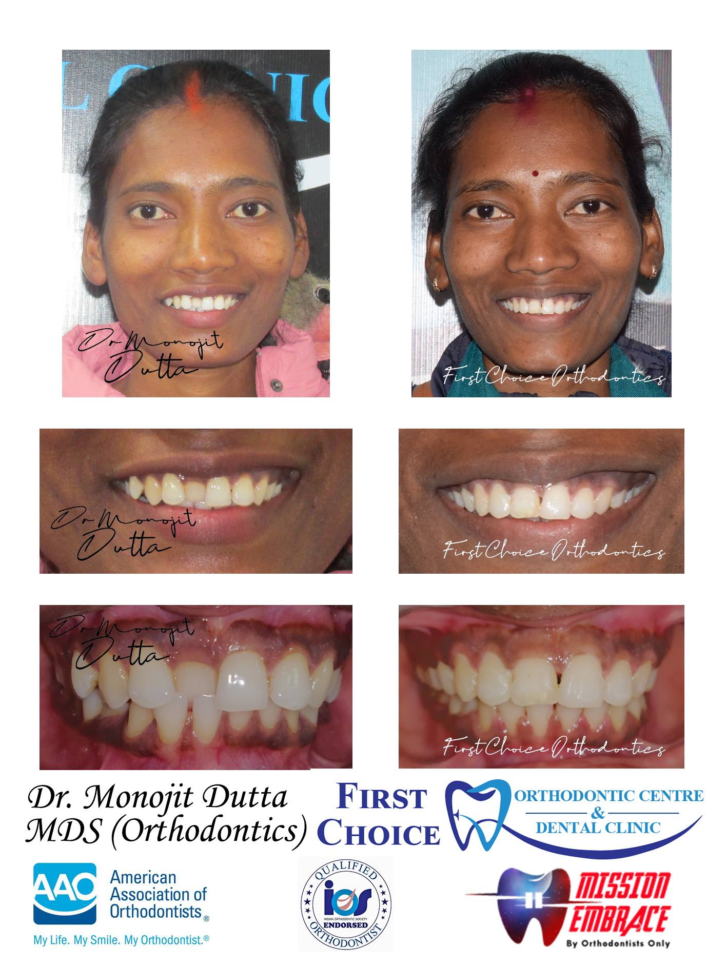 Dental Equipment at First Choice Ranchi