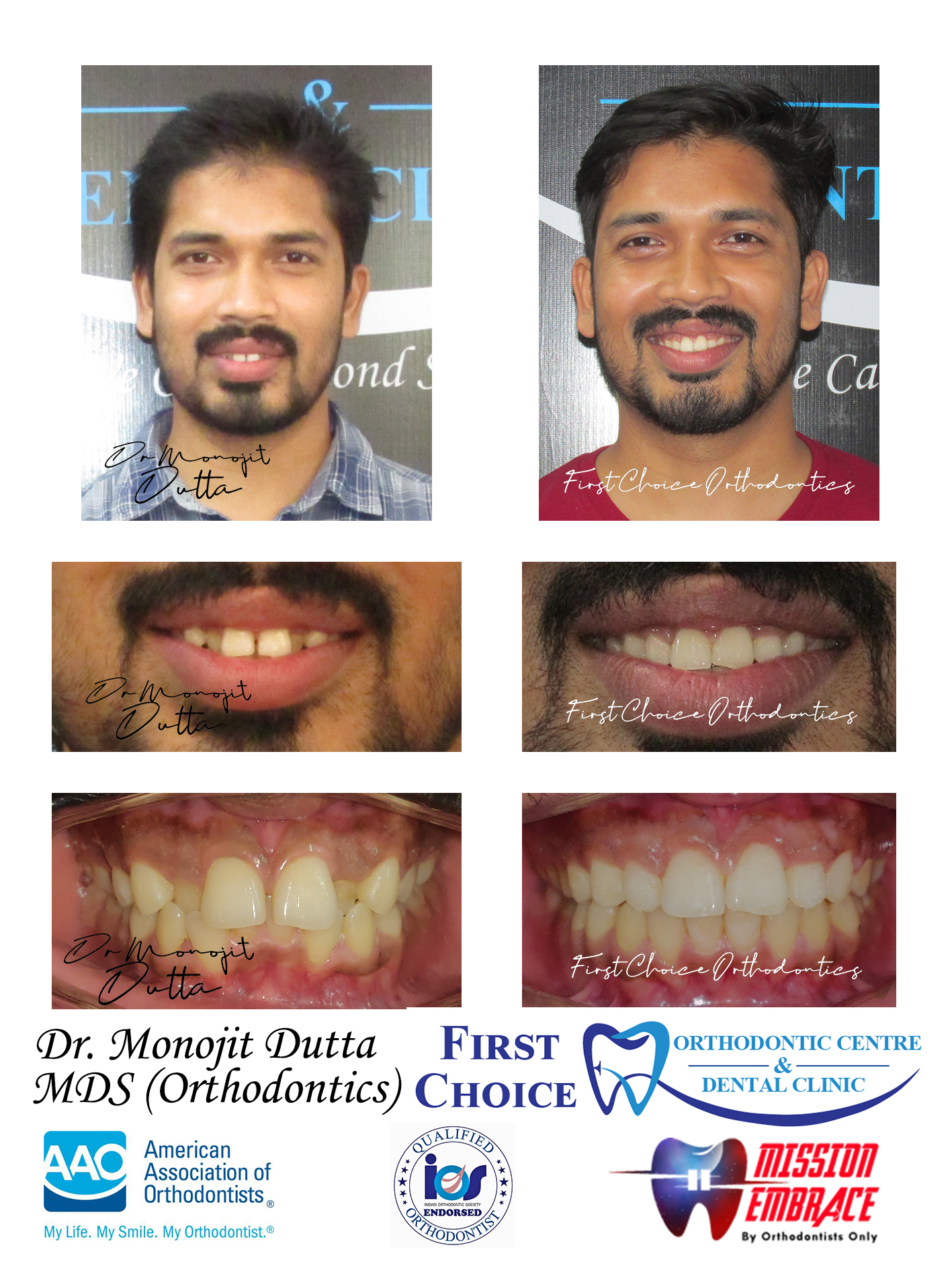 Dental Equipment at First Choice Ranchi